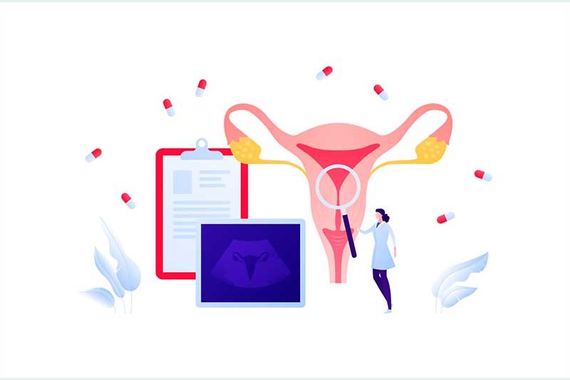 desenho de uma médica analisando uma imagem de um sistema reprodutor feminino