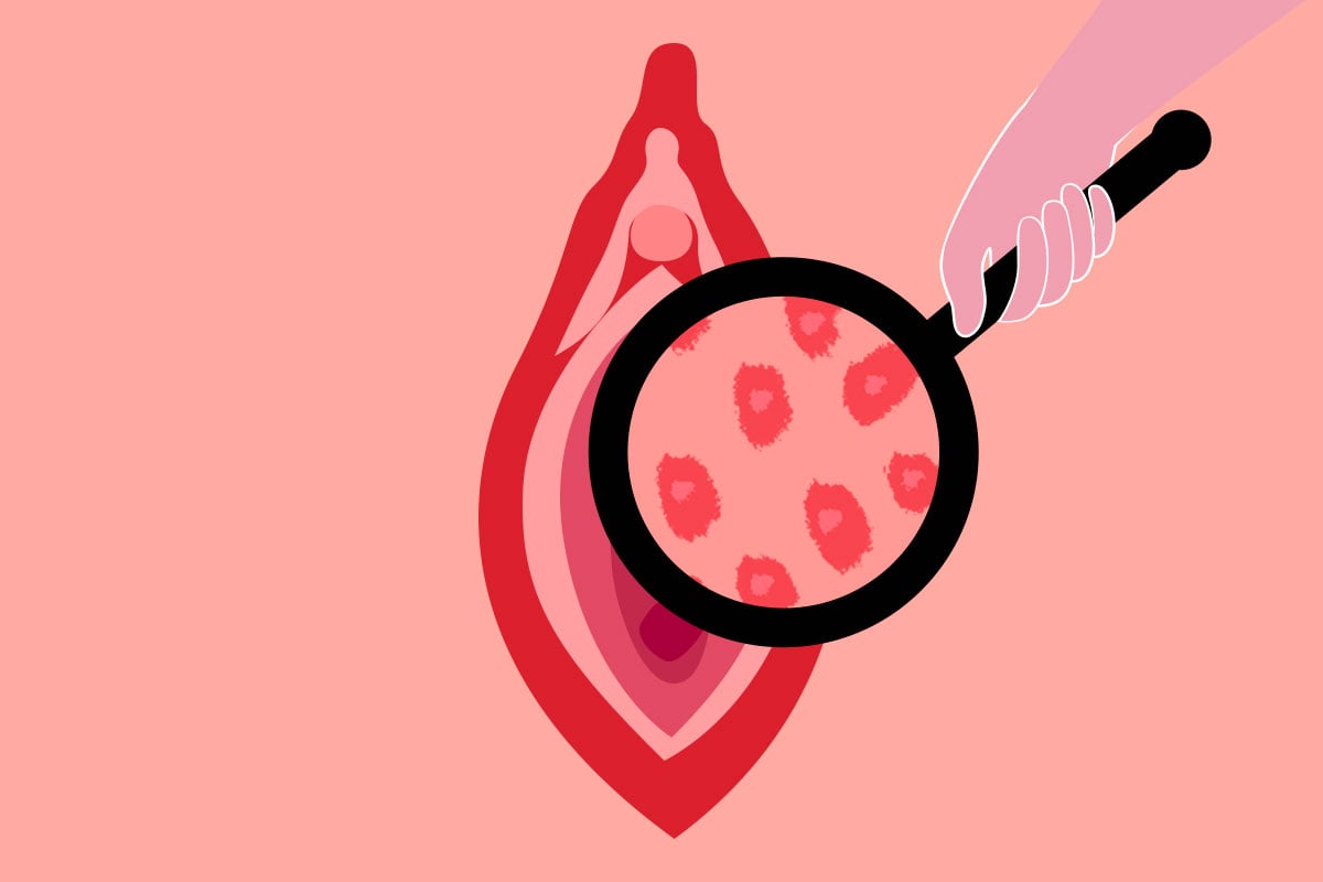 desenho de uma vulva feminina com uma lupa aproximando sobre os lábios