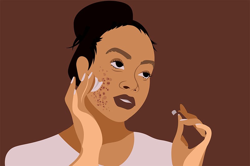 desenho de uma menina passando um creme no rosto para acnes